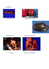 Kvėpavimo organų patologija 20 puslapis