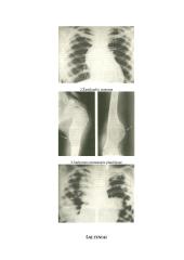 Onkologinės ligos 8 puslapis
