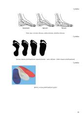 Plokščiapėdystė. Korekcija ir profilaktinės priemonės 10 puslapis
