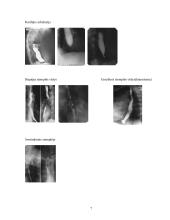 Stemplės susiaurėjimų priežastys ir rentgeno diagnostika 7 puslapis