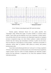 Elektrokardiogramos signalų apdorojimas 13 puslapis