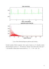 Elektrokardiogramos signalų apdorojimas 9 puslapis