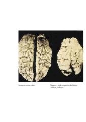 Įgimtas vaiko alkoholinis sindromas 7 puslapis