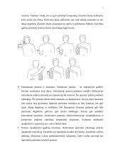 Viršutinių galūnių amputacija 7 puslapis