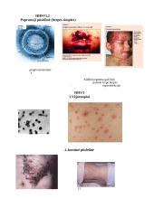 Herpes virusai 15 puslapis