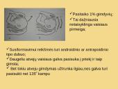 Galvinės pirmeigos užpakalinis vaizdas 2 puslapis