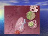 Pneumonija 15 puslapis