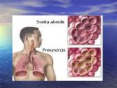 Pneumonija 3 puslapis