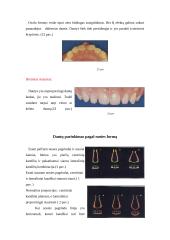 Priekinių dantų atstatymas 13 puslapis