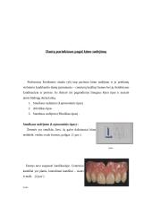 Priekinių dantų atstatymas 4 puslapis