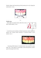 Priekinių dantų atstatymas 5 puslapis