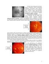 Diabetinė retinopatija 7 puslapis