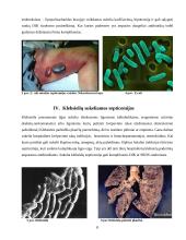 Gramneigiamų bakterijų sukeliamų septicemijų patogenezė 6 puslapis