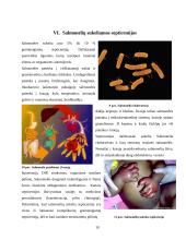 Gramneigiamų bakterijų sukeliamų septicemijų patogenezė 8 puslapis