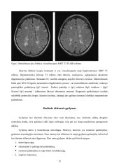 Klastinga liga - išsėtinė sklerozė 12 puslapis