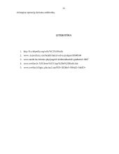 Mitralinio širdies vožtuvo prolapsas 13 puslapis