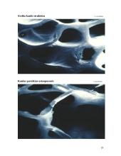 Osteoporozė 18 puslapis