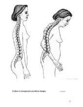 Osteoporozė 20 puslapis