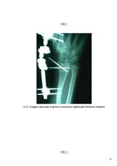 Paciento dešiniosios rankos stipinkaulio lūžio kineziterapijos planas 14 puslapis