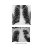 Periferinių plaučių navikų rentgenodiagnostika 5 puslapis