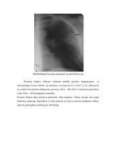 Periferinių plaučių navikų rentgenodiagnostika 7 puslapis