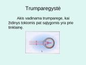 Akys ir akiniai 8 puslapis