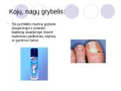 Antimikrobiniai vaistai 14 puslapis