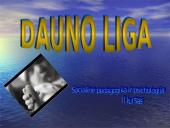 Dauno sindromas