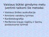 Gimdyvės priežiūra 17 puslapis