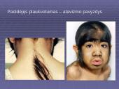 Morfologiniai ir biogeografiniai evoliucijos įrodymai 20 puslapis