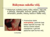 Rūkymo pasekmės 11 puslapis