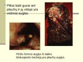 Rūkymo pasekmės 13 puslapis