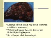 Rūkymo pasekmės 14 puslapis