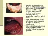 Rūkymo pasekmės 15 puslapis