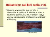 Rūkymo pasekmės 16 puslapis