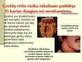 Rūkymo pasekmės 17 puslapis