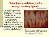 Rūkymo pasekmės 3 puslapis