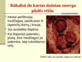 Rūkymo pasekmės 8 puslapis