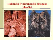 Rūkymo pasekmės 10 puslapis