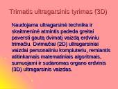 Garsas bei ultragarsas 15 puslapis