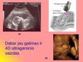 Garsas bei ultragarsas 16 puslapis