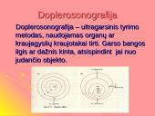 Garsas bei ultragarsas 17 puslapis
