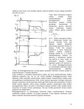 Stačiakampiai impulsų generatoriai 15 puslapis