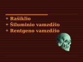 Šviesos banginės savybės ir šviesos reiškinys 15 puslapis