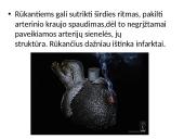 Kodėl žmonės rūko bei rūkymo žala 7 puslapis