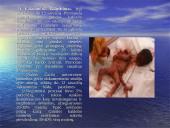 Abortai ir eutanazija 7 puslapis