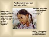 AIDS - XXI amžiaus maras 4 puslapis