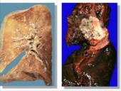 Aplinka be tabako dūmų 17 puslapis