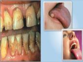 Aplinka be tabako dūmų 18 puslapis