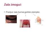 Druskos rūgštis 6 puslapis